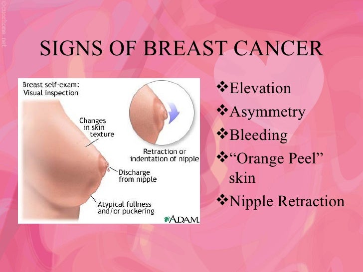 breasts are bleeding Hong kong porn ffm